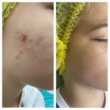 Ольга Друченко, Київ Фото - 18