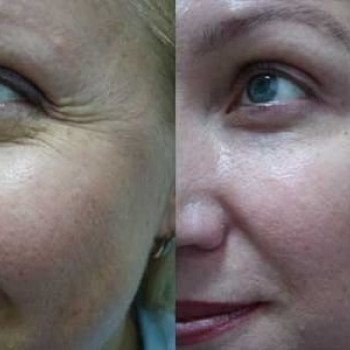 Наталья Анжуйская, Запоріжжя Фото - 11