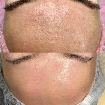 Валентина Стиранка, Чернівці Фото - 12