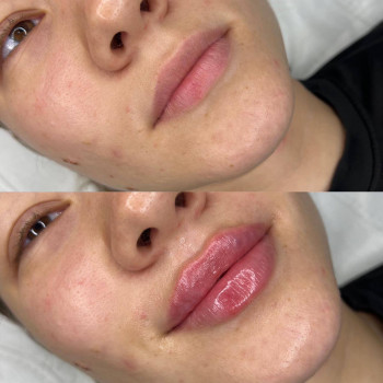 Валентина Стиранка, Чернівці Фото - 25