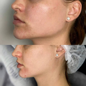 Валентина Стиранка, Чернівці Фото - 27