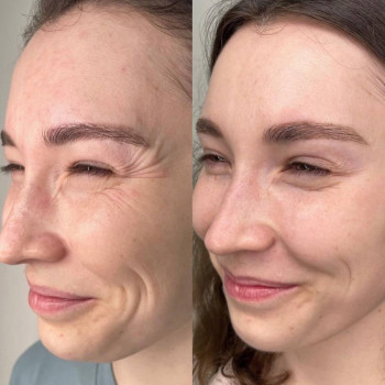 Валентина Стиранка, Чернівці Фото - 30