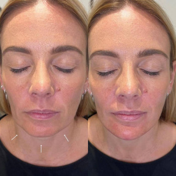 Валентина Стиранка, Чернівці Фото - 33