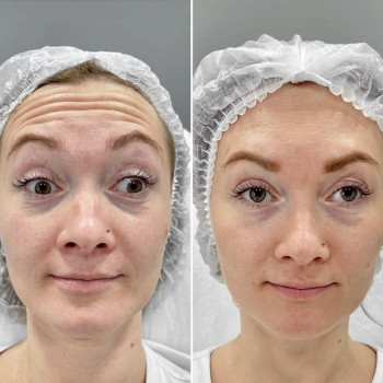 Валентина Стиранка, Чернівці Фото - 36