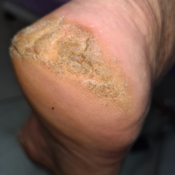 Тетяна Петрова, Чорноморськ Фото - 25