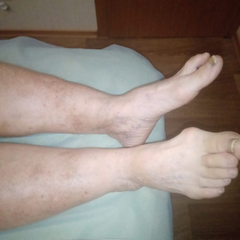 Мануальна терапія, остеопатія
                    Остеопат Юрий Кропивницкий