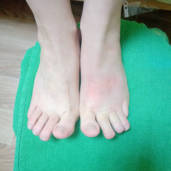 Мануальна терапія, остеопатія
                    Остеопат Юрий Кропивницкий