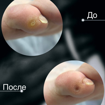 Наталья Балаховская, Кременчуг Фото - 61