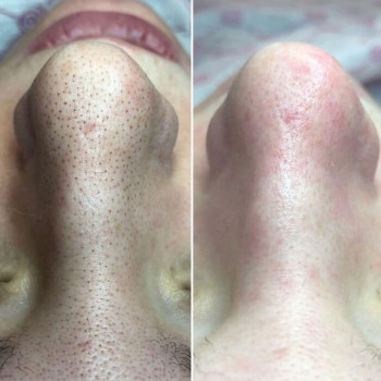 До та після