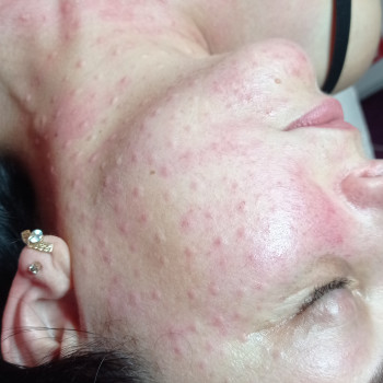 Марина Щегловская, Никополь Фото - 10