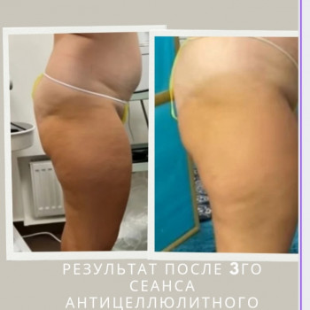 Фаїна Березка, Черноморск Фото - 6