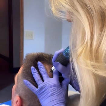 Трихопигментация
                    Мастер перманентного макияжа Анна Киев