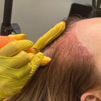 Трихопигментация
                    Мастер перманентного макияжа Анна Киев