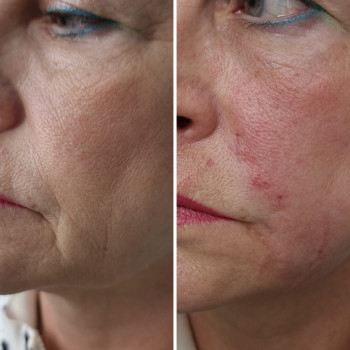 Александра , Київ Фото - 5