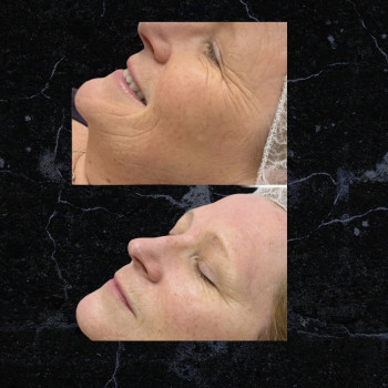 Маша Цой, Киев Фото - 31