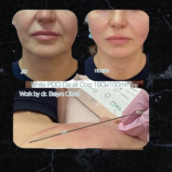 Маша Цой, Киев Фото - 36