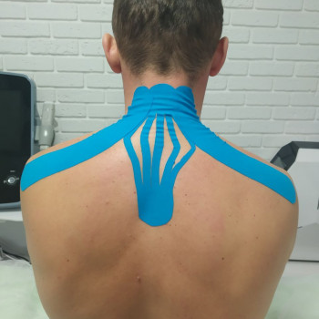 Кінезіотейпування від болю в шийному відділенні