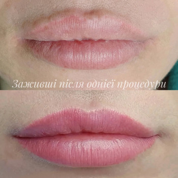 Перманентний макіяж/татуаж губ
                    Майстер перманентного макіяжу Светлана Київ