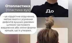 Отопластика Медичний центр  Луцьк