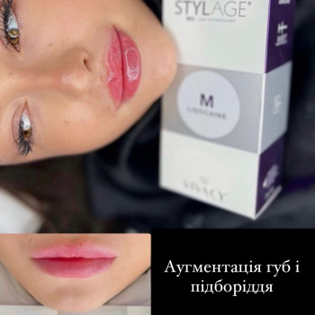 Ольга Беркутенко, Кривий Ріг Фото - 6