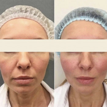 Ольга Беркутенко, Кривий Ріг Фото - 8