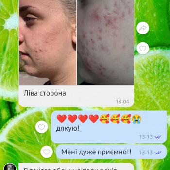 Надія Бойчук, Івано-Франківськ Фото - 1