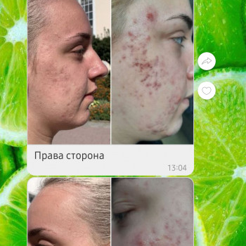 Надія Бойчук, Івано-Франківськ Фото - 2