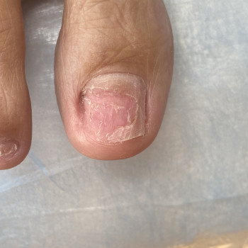 Олена Дудік, Полтава Фото - 5