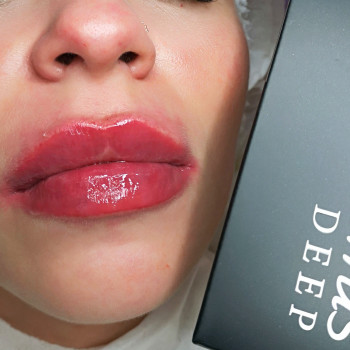 Демократичний Neuramis deep