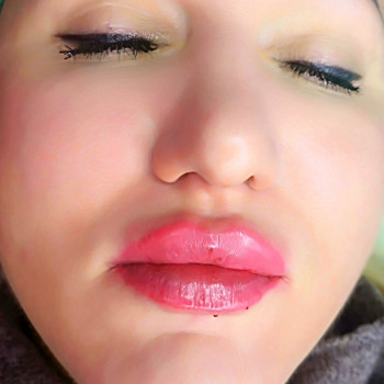 Демократичний Neuramis deep