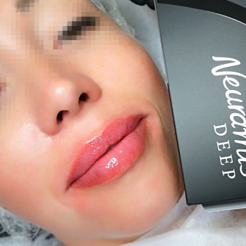 Демократичний Neuramis deep