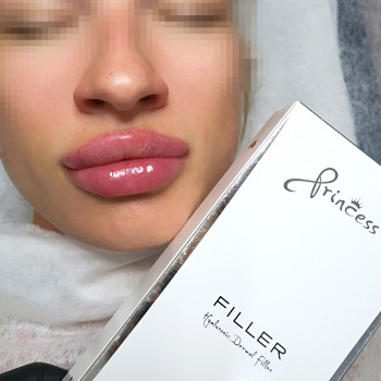 Преміальний філер
Princess filler