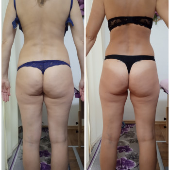 Світлана Сайліева, Полтава Фото - 19