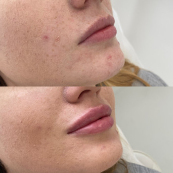 Анастасия Ефимчук Анастасія Єфимчук, Житомир Фото - 2