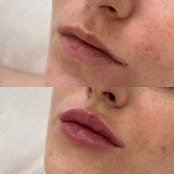 Анастасия Ефимчук Анастасія Єфимчук, Житомир Фото - 9