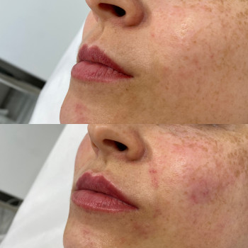 Анастасия Ефимчук Анастасія Єфимчук, Житомир Фото - 8