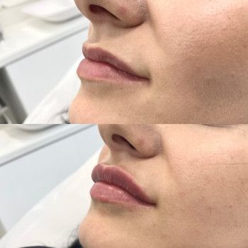 Анастасия Ефимчук Анастасія Єфимчук, Житомир Фото - 7