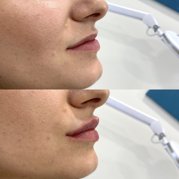 Анастасия Ефимчук Анастасія Єфимчук, Житомир Фото - 6