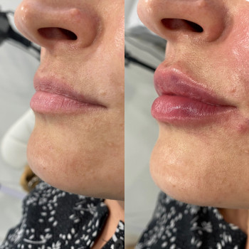 Анастасия Ефимчук Анастасія Єфимчук, Житомир Фото - 5