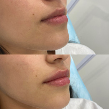 Анастасия Ефимчук Анастасія Єфимчук, Житомир Фото - 4