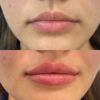 Анастасия Ефимчук Анастасія Єфимчук, Житомир Фото - 3