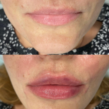 Анастасия Ефимчук Анастасія Єфимчук, Житомир Фото - 1