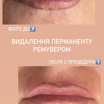 Діана Чупла, Кривий Ріг Фото - 12