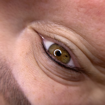 Напилення міжвійки
                    Бровист Олена Житомир