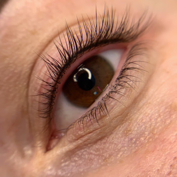 Напилення міжвійки
                    Бровист Олена Житомир