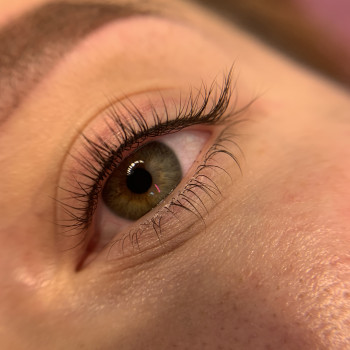 Напилення міжвійки
                    Бровист Олена Житомир