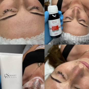 уход за лицом, косметология лица