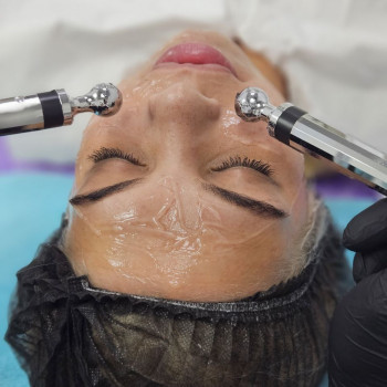 Мікрострумова терапія обличчя