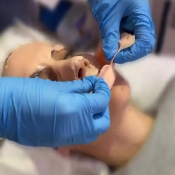 Альгінатна маска Освітлення для обличчя, або обличчя, шиї, декольте
                    Косметологический центр WE Cosmetology Одесса