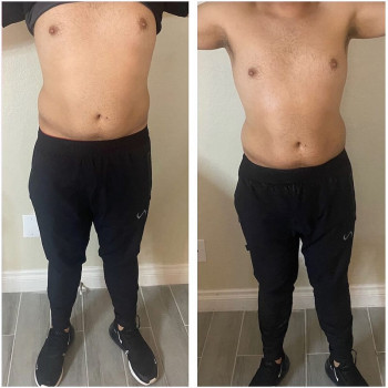 Активна програма корекції фігури (кавітація+вакуумний масаж+рф-ліфтинг)
                    Косметологический центр WE Cosmetology Киев